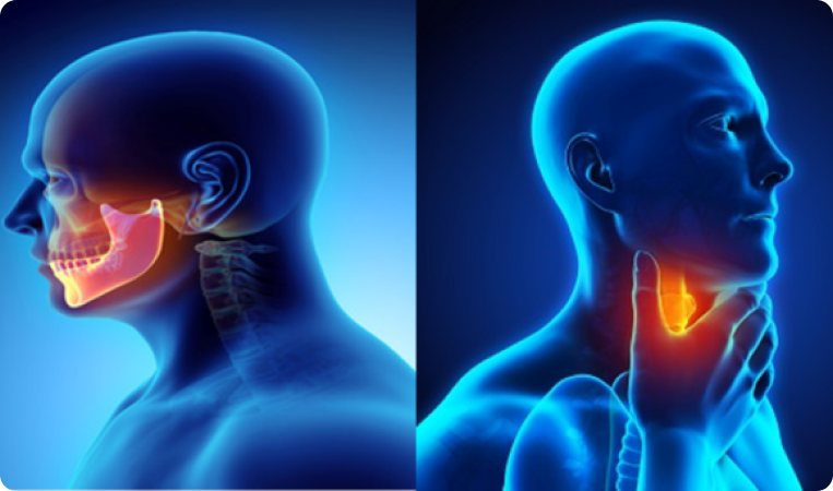 The Role of Adaptive Radiotherapy in Locally Advanced Head and Neck Cancer: A Dosimetric Analysis by