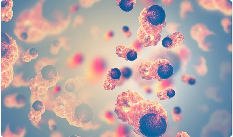 Retrospective Trial on Ifosfamide and Adriamycin Regimen in Soft Tissue Sarcomas