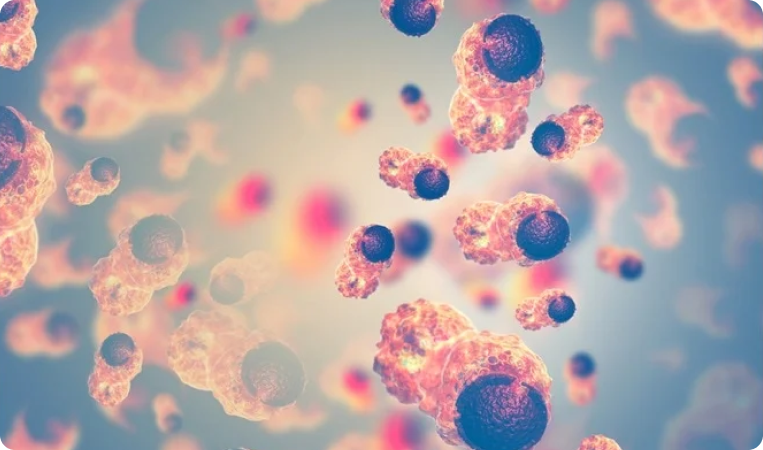 Retrospective Trial on Ifosfamide and Adriamycin Regimen in Soft Tissue Sarcomas